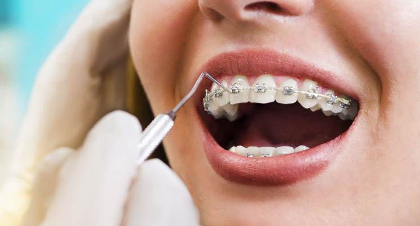 Orthodontist Treatment