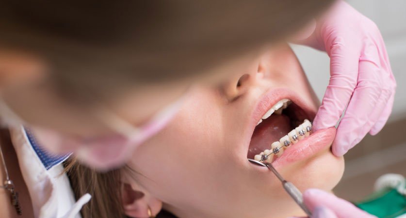 Aventura orthodontists