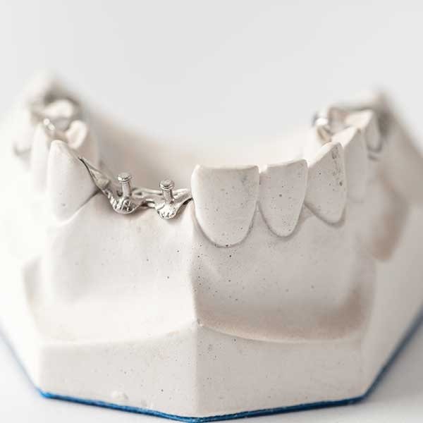 dental implant options for seniors